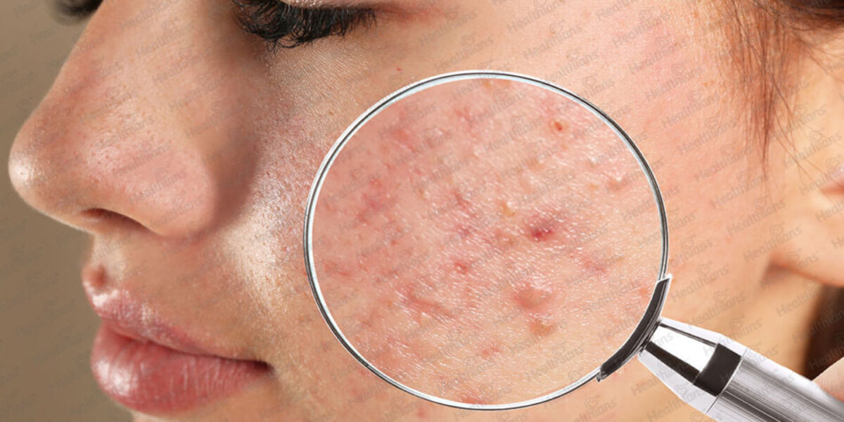 Skin issues: Understanding and Overcoming Common Skin Challenges